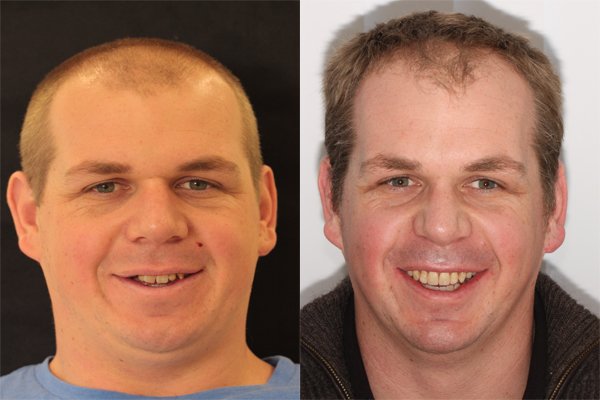 glenview dental treatment